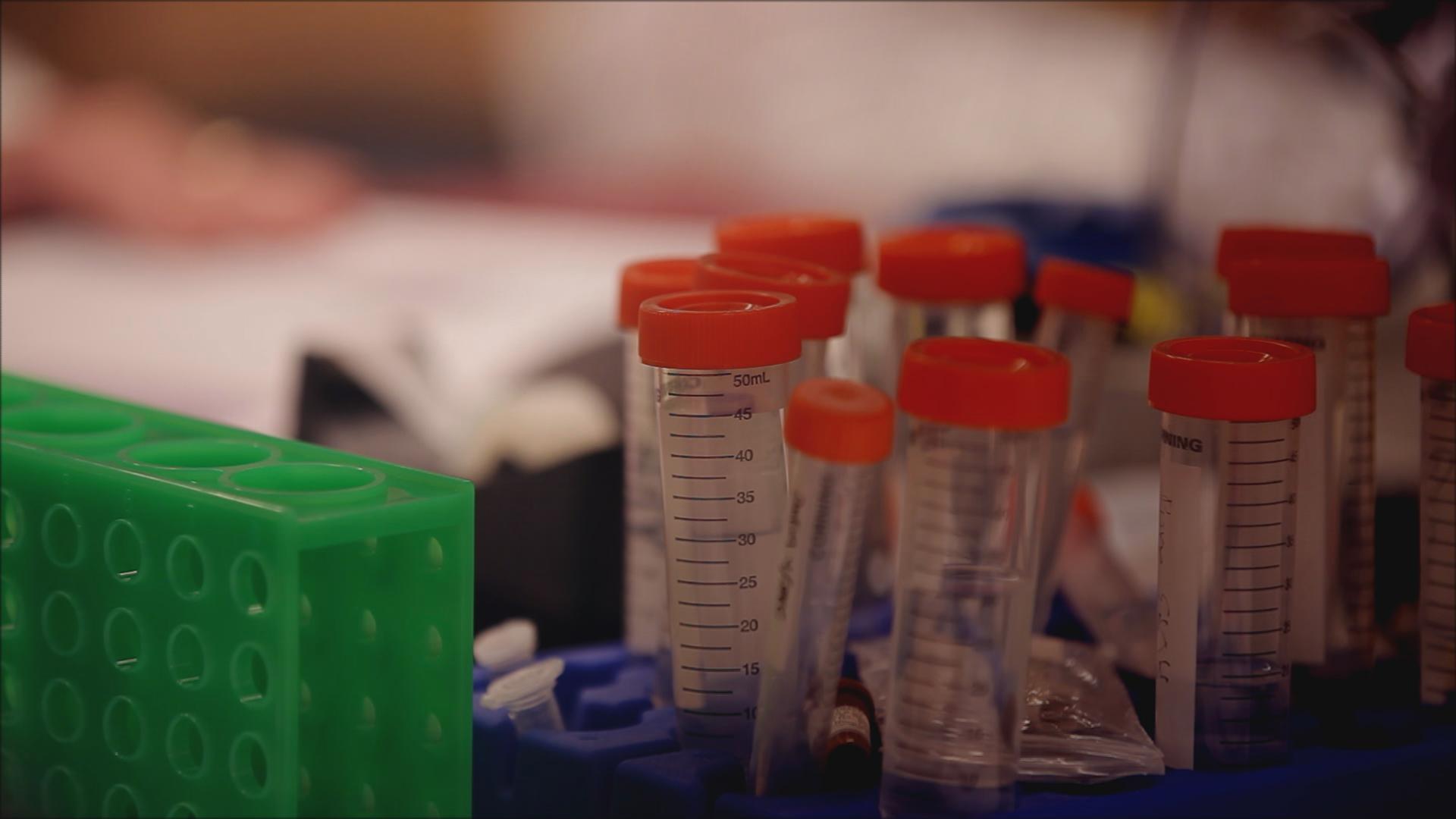 test tubes