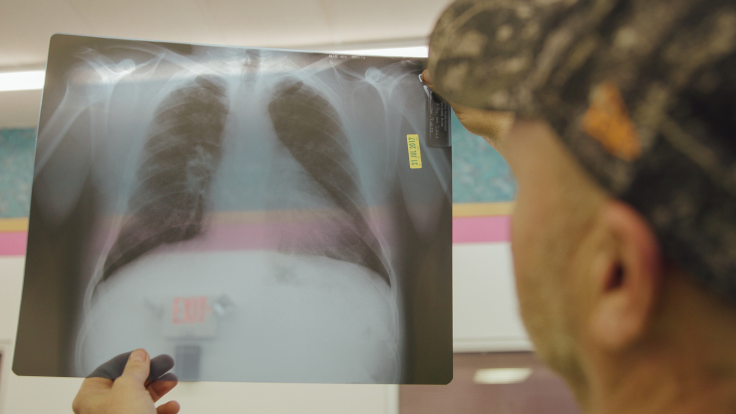 Black Lung-Coals Deadly Dust-Frontline1